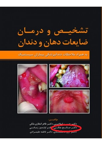 تشخیص و درمان ضایعات دهان و دندان