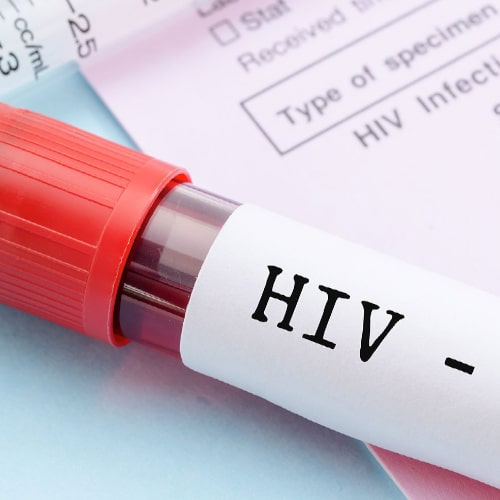 آزمایش ایدز و هپاتیت