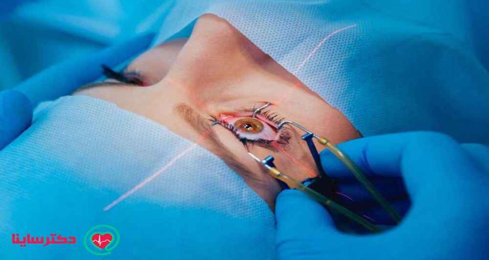 بهترین روش درمان آب سیاه چشم چیست؟ بهترین روش درمان آب سیاه چشم چیست؟