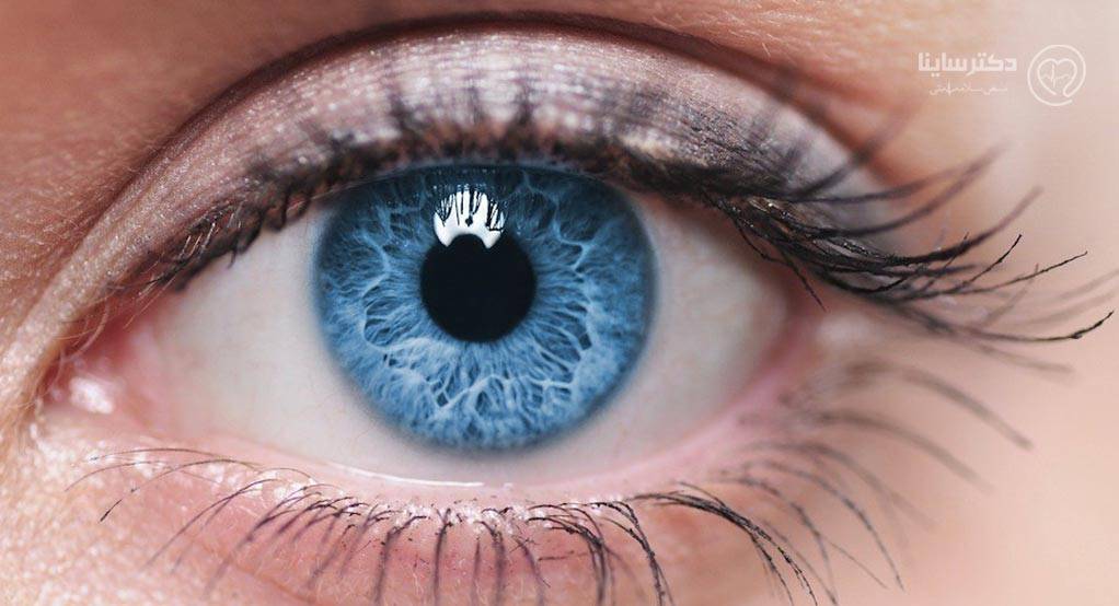 بیماری مگس پران چشم چیست؟ بیماری مگس پران چشم چیست؟