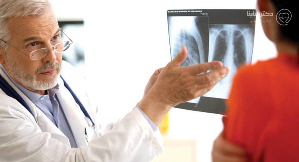 سرطان ریه چگونه تشخیص داده میشود؟ سرطان ریه چگونه تشخیص داده میشود؟
