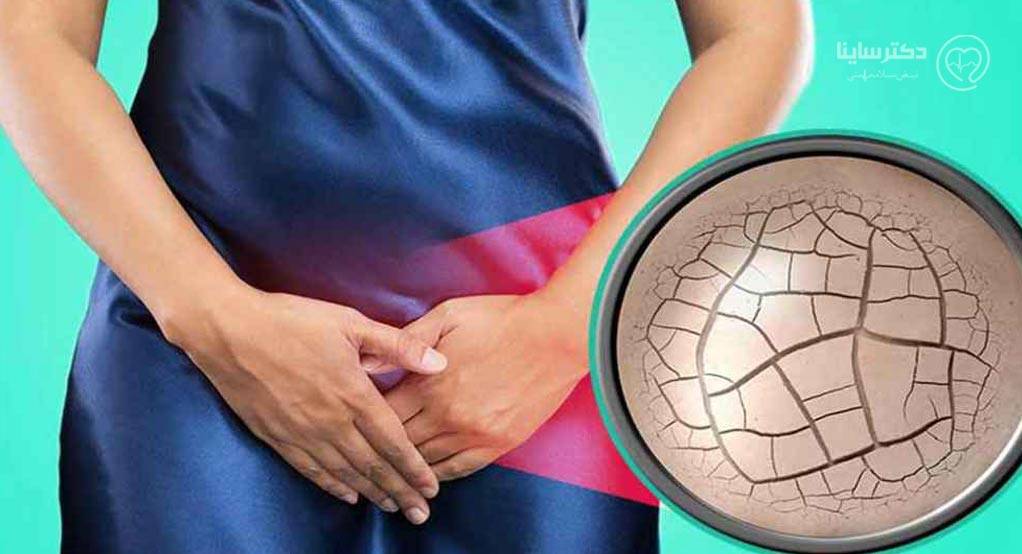 به چه علت دچار خشکی واژن شدهام؟ به چه علت دچار خشکی واژن شدهام؟