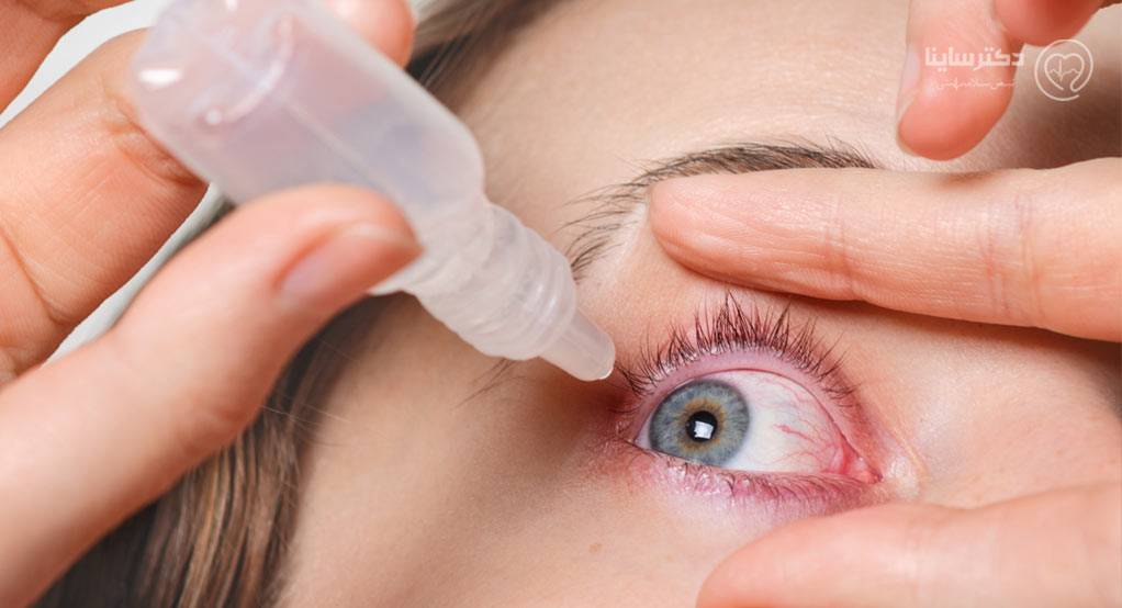درمان خشکی چشم با قطره فلوکورت