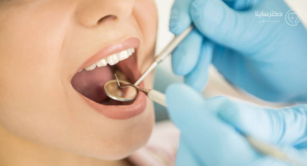 عفونت دندان بعد از عصب کشی فیلم عصب کشی دندان