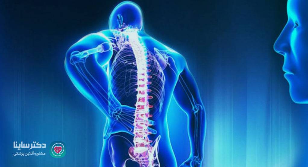 درد سیاتیک در چه کسانی مشکلساز میشود؟ درد سیاتیک در چه کسانی مشکلساز میشود؟