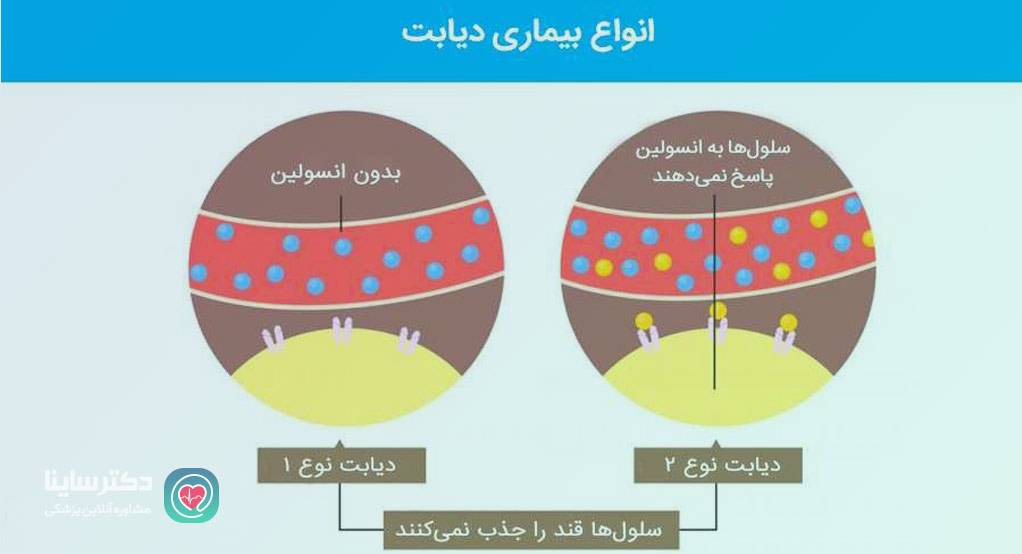 تفاوت دیابت نوع یک و دیابت نوع دو