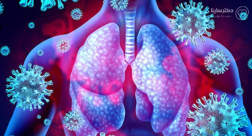 بهترین قرص آنتی بیوتیک و داروی عفونت ریه کدام است؟