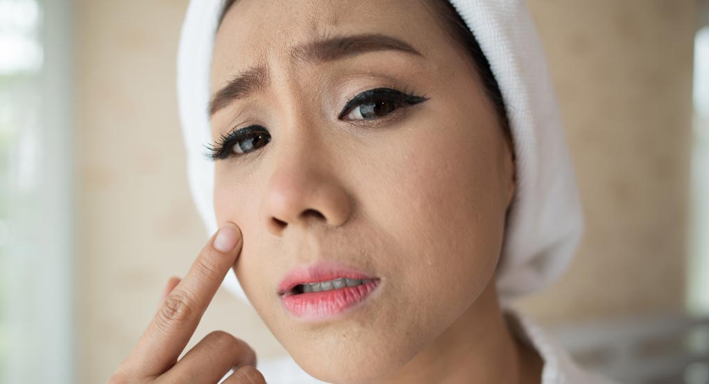 آیا لیزر برای درمان جوش صورت مفید است؟