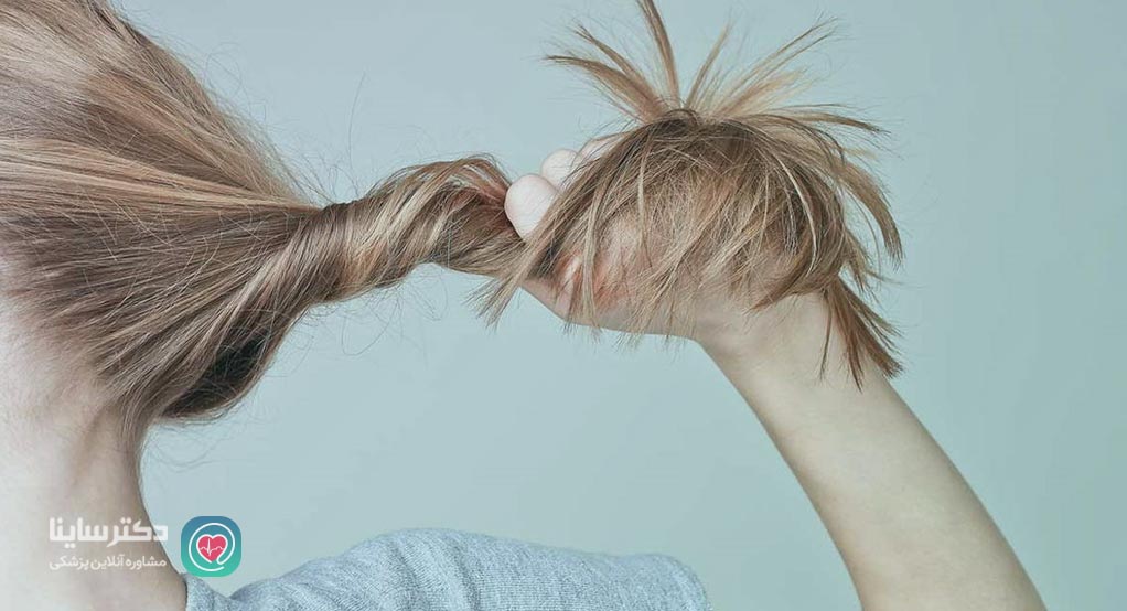 جلوگیری از ریزش مو ارثی