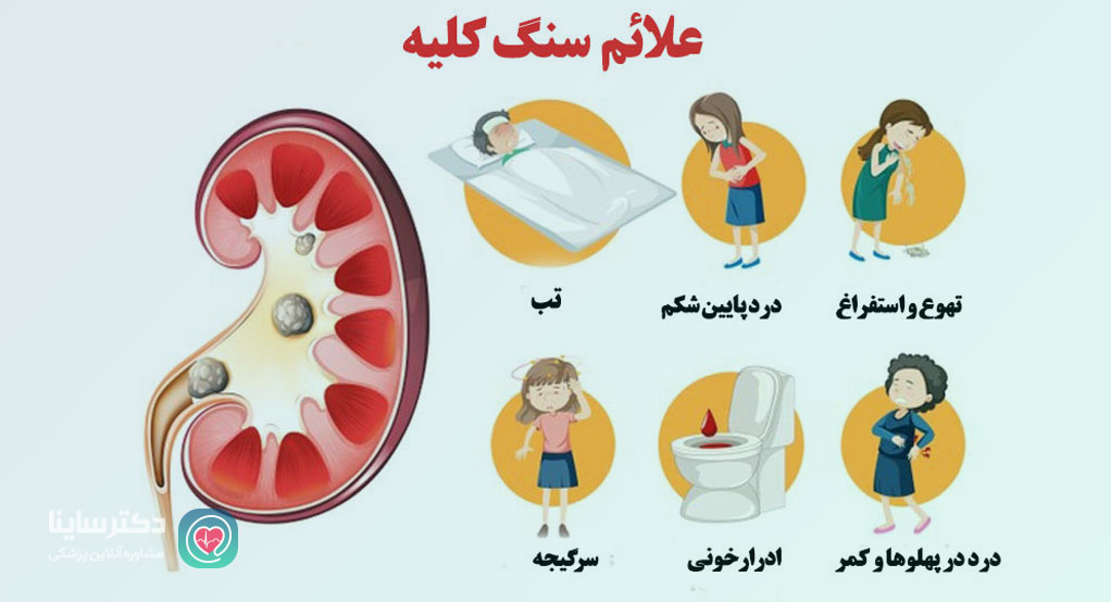 علائم سنگ کلیه