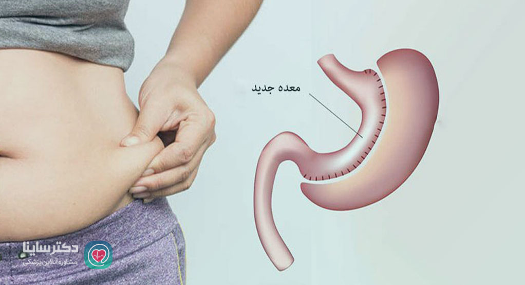 عوارض جراحی چاقی