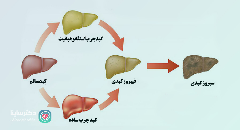 گرید کبد چرب