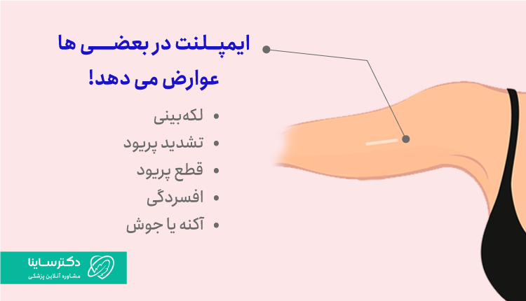 عوارض ایمپلنت ضد بارداری