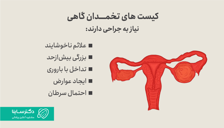 کیست‌های تخمدان در شرایط خاصی نیاز به جراحی دارند.