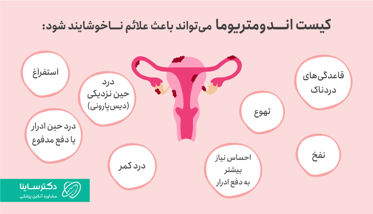 علائم کیست اندومتریوما