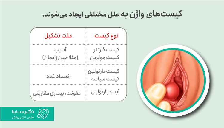 علت کیست واژن