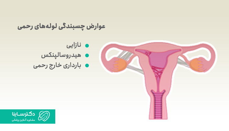 عوارض چسبندگی لوله رحمی