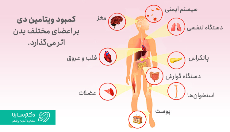 کمبود ویتامین دی بر اعضای مختلف بدن تاثیر می‌گذارد.