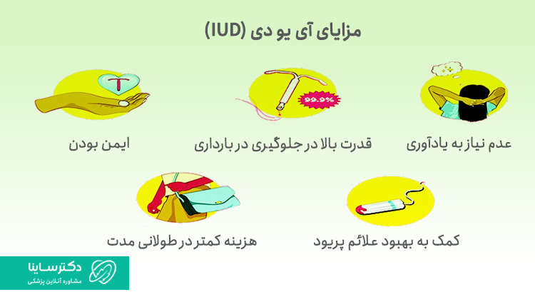 مزایای آی یو دی