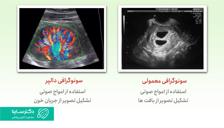 تفاوت سونوگرافی داپلر و سونوگرافی معمولی