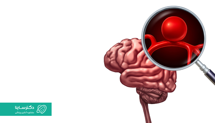 آنوریسم مغزی: علائم، تشخیص و روش‌های درمان