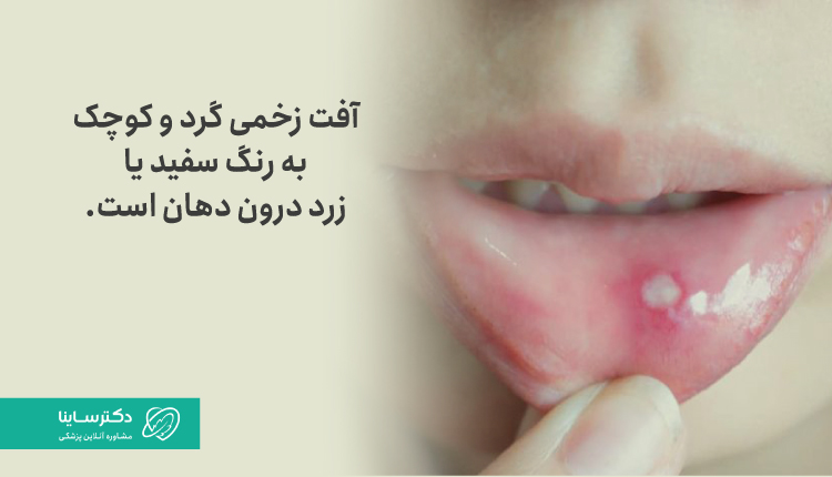 شکل ظاهری آفت دهان کودکان