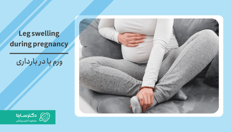 ۱۲ روش برای درمان ورم پا در بارداری (ساق و مچ پا) + علل