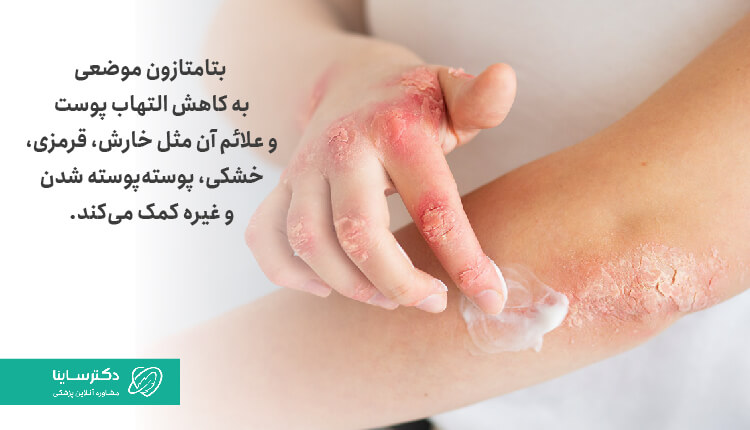 پماد بتامتازون، کاهش التهاب پوست و علائم آن مثل خارش، قرمزی، خشکی، پوسته‌پوسته شدن و غیره است.