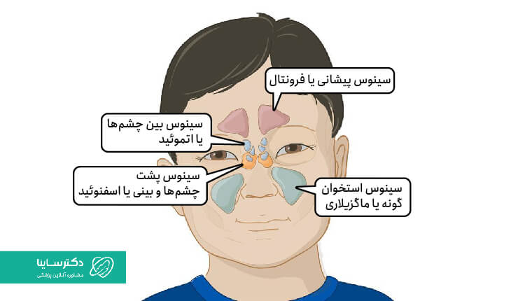 انواع محل قرارگیری سینوس‌های کودکان